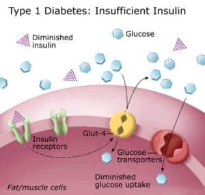 Diabetes Diagram